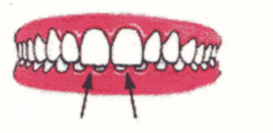 Ortodontia la copii 7 semne avertisment la copilul de 7 ani gokid 2