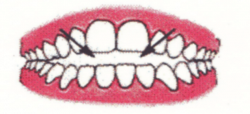Ortodontia la copii 7 semne avertisment la copilul de 7 ani gokid 3