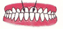 Ortodontia la copii 7 semne avertisment la copilul de 7 ani gokid 4