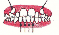 Ortodontia la copii 7 semne avertisment la copilul de 7 ani gokid 5