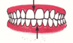 Ortodontia la copii 7 semne avertisment la copilul de 7 ani gokid 6