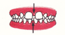 Ortodontia la copii 7 semne avertisment la copilul de 7 ani gokid 7